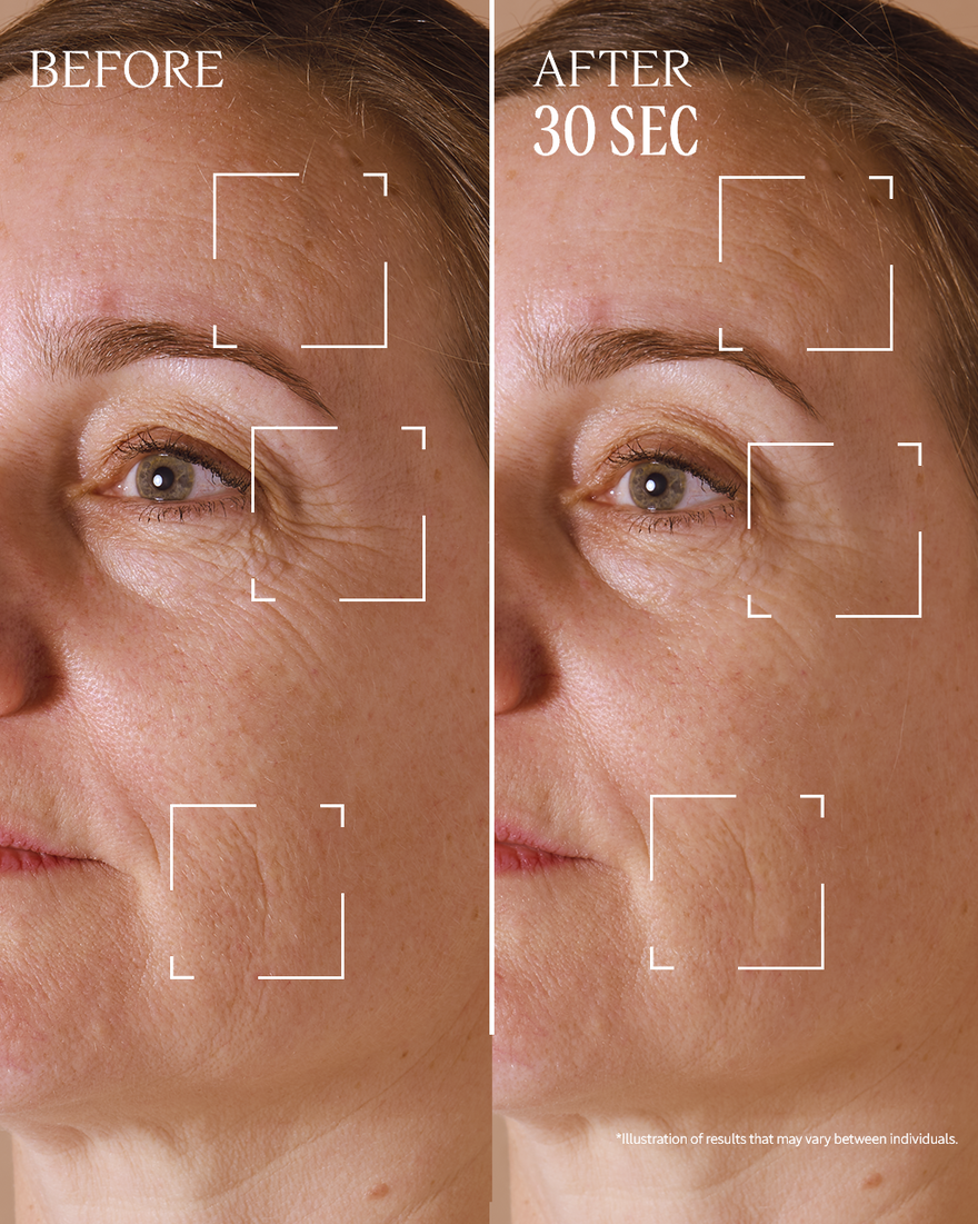 view 9/10 of Immortelle Divine Targeted Wrinkle Care, , RECT